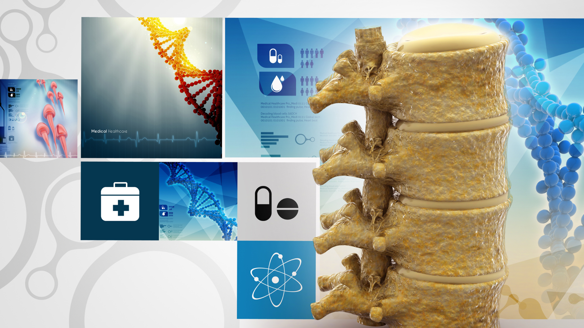 spinal cord stimulation for neck pain