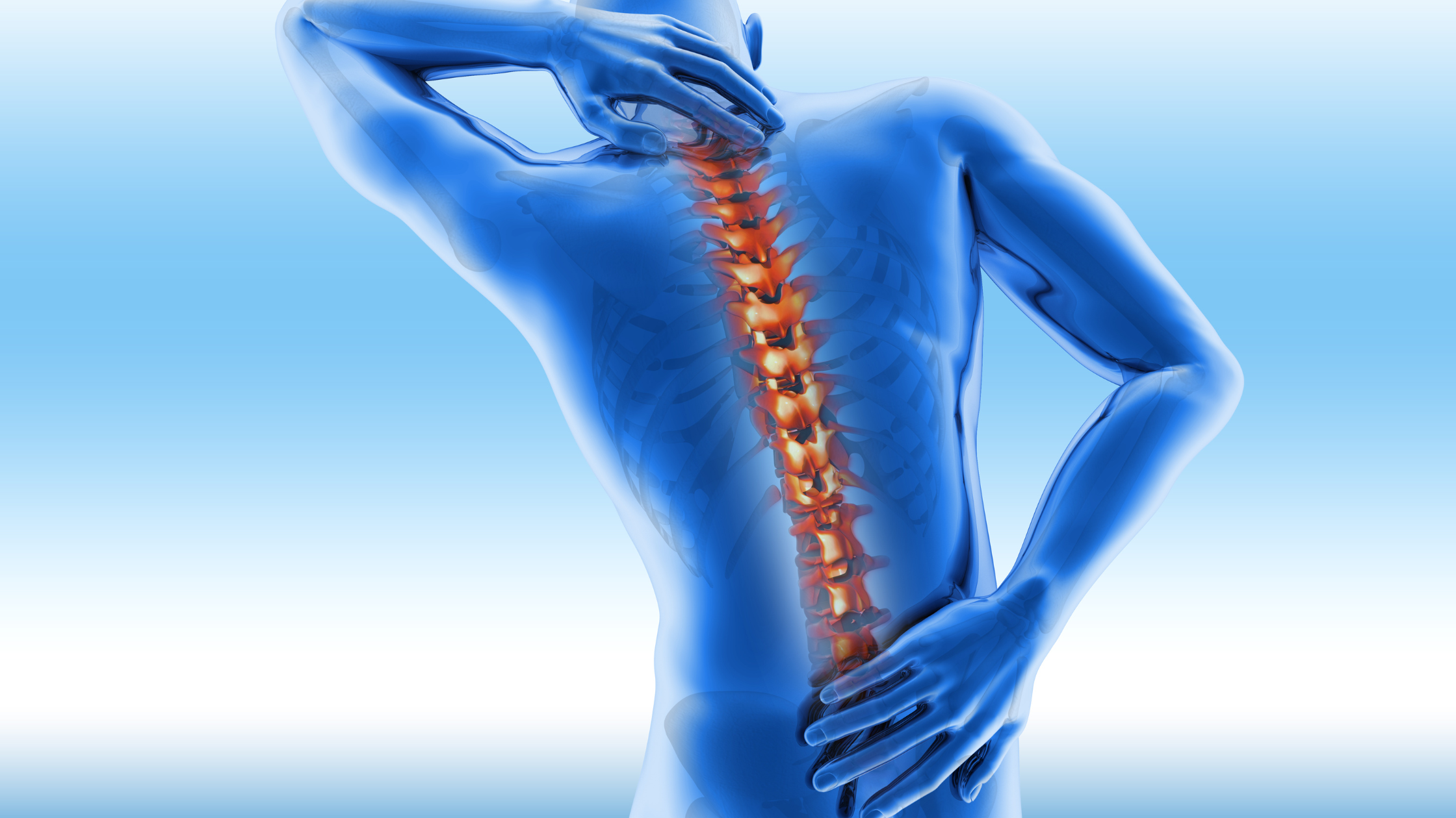 compression fractures treated with vertebroplasty and kyphoplasty