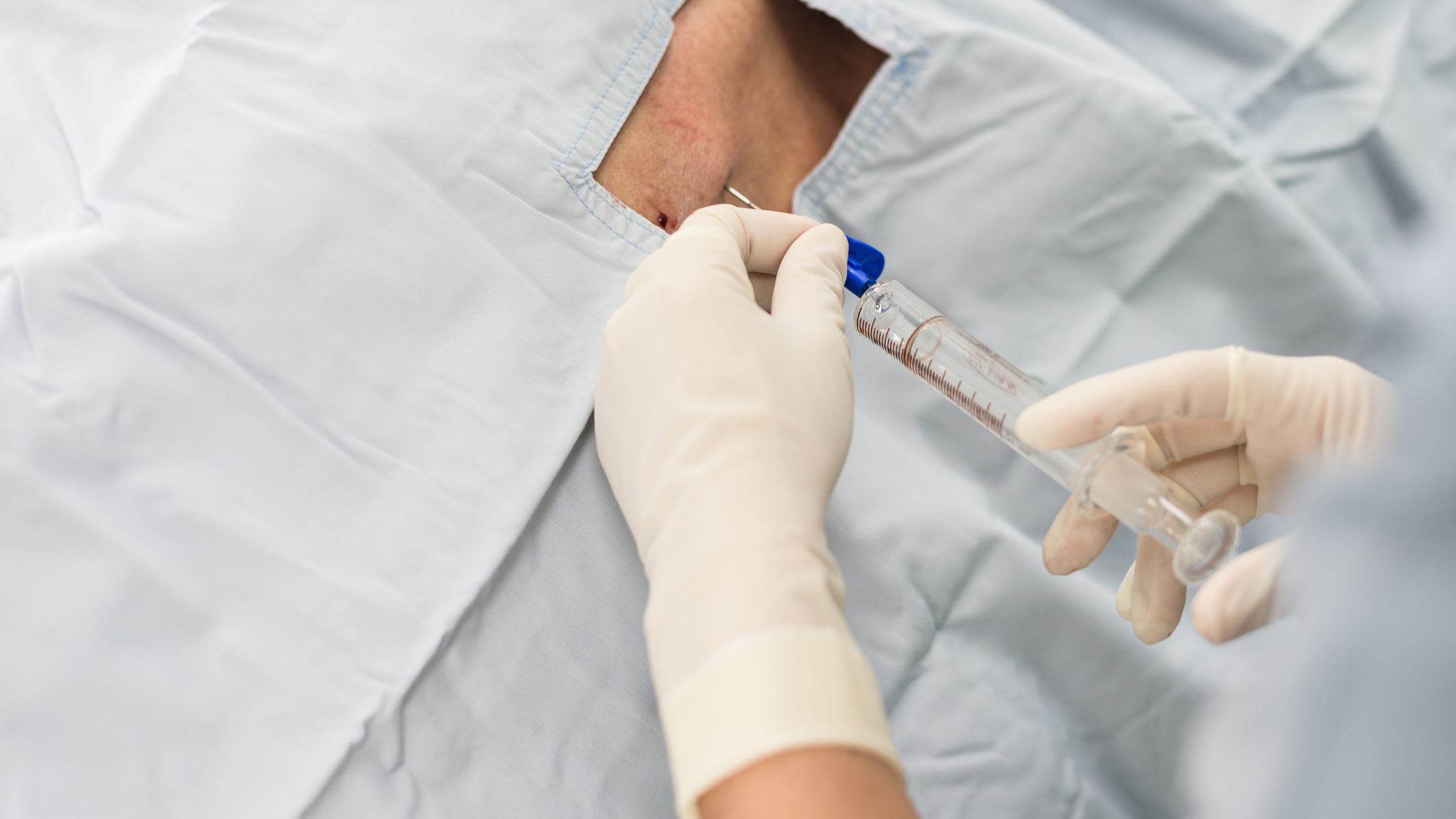 epidural steroid injections