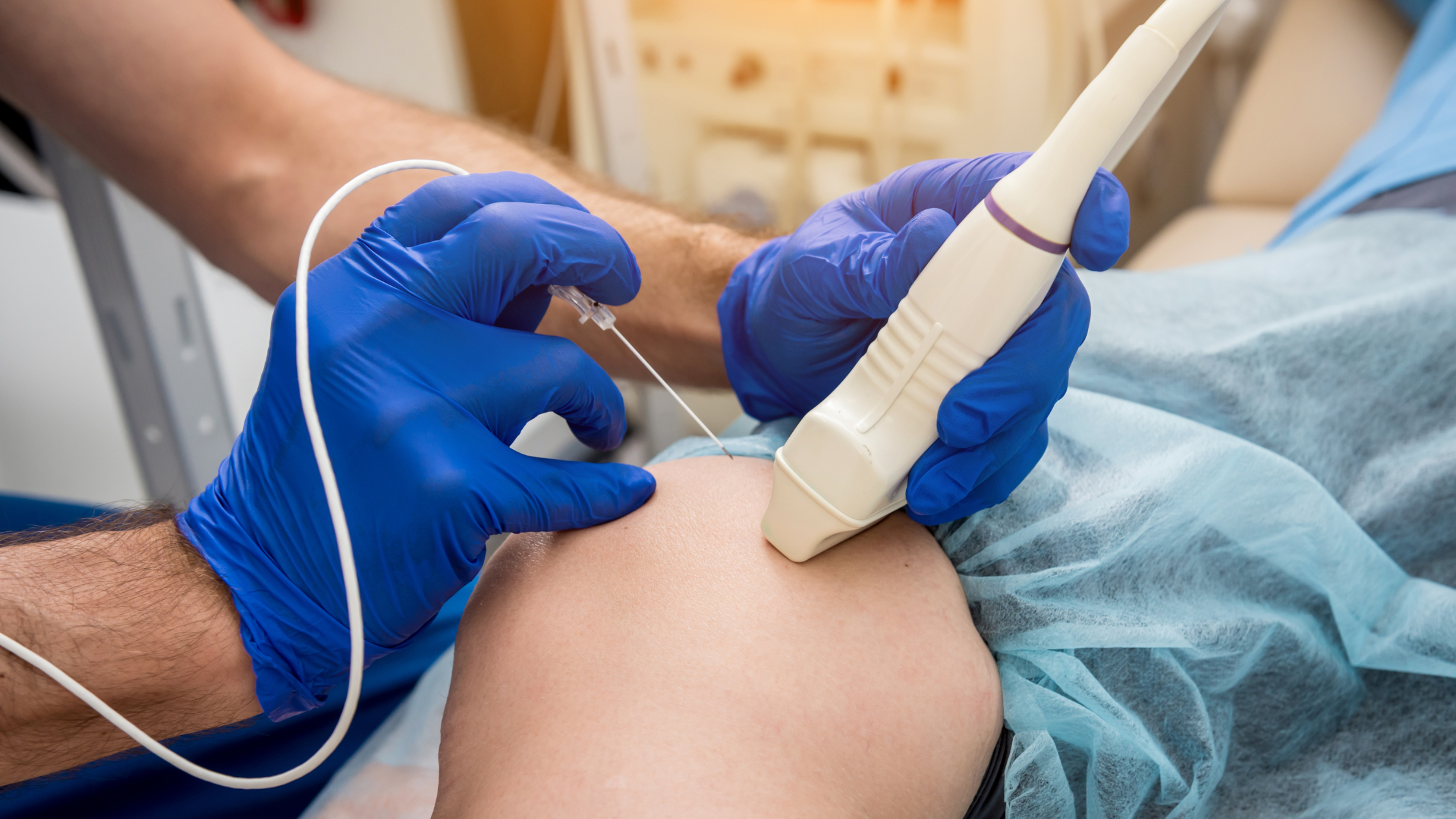 radiofrequency ablation