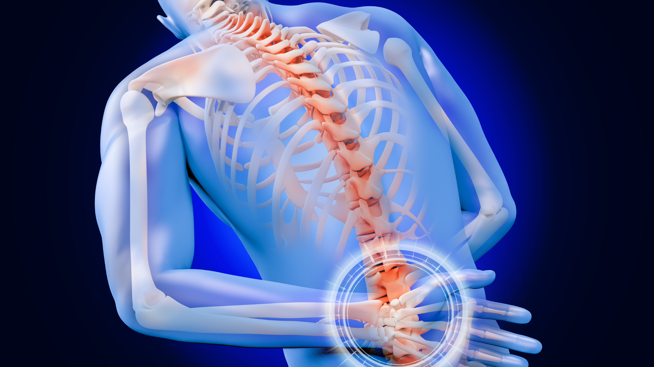 Intracept® Procedure