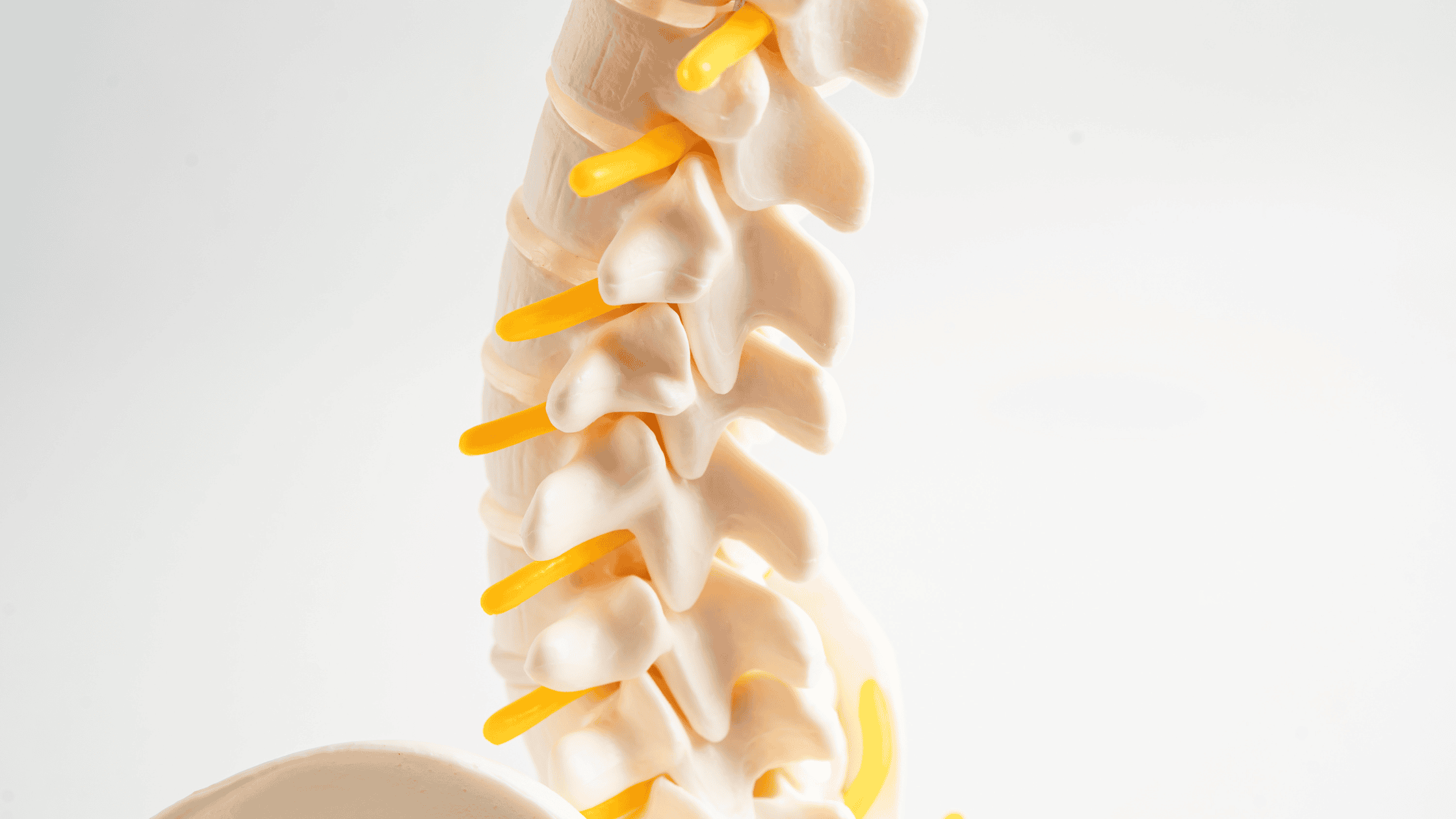 spinal arthritis